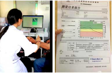 国产骨密度仪能够准确评估骨质状态和可能发生骨折的风险早发现早治疗