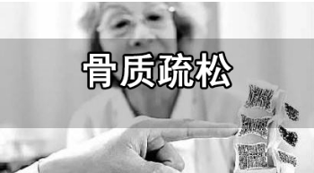 超声骨密度检测仪厂家
